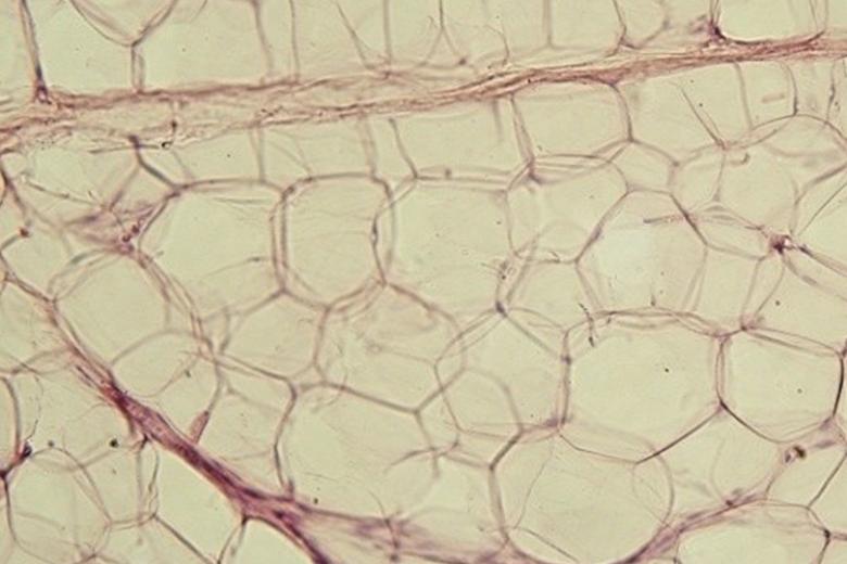 Adipose tissue