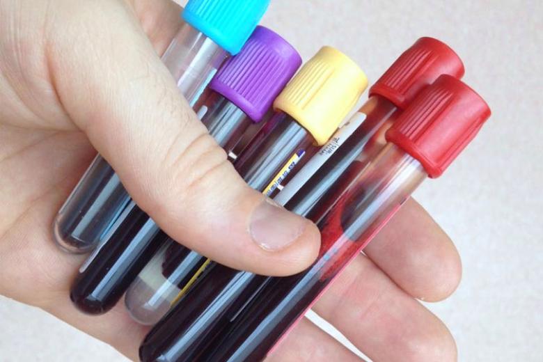 Biomarker heart attack