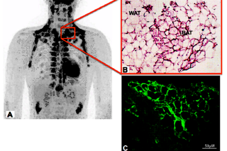 Brown adipose tissue