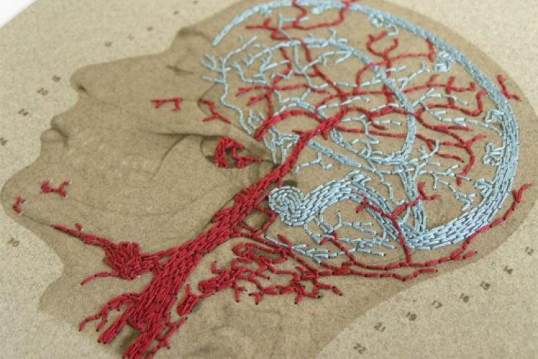 A picture of a brain and all nerves inside it