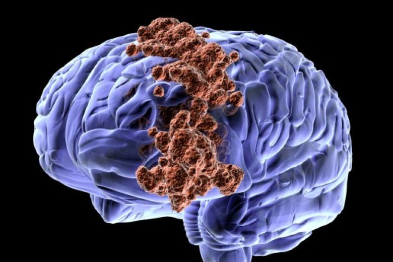 brain
