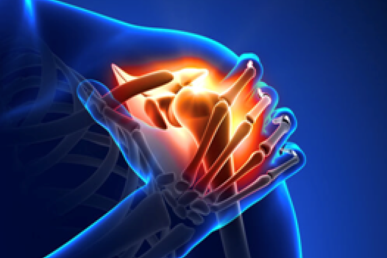 Shoulder/arm disorders