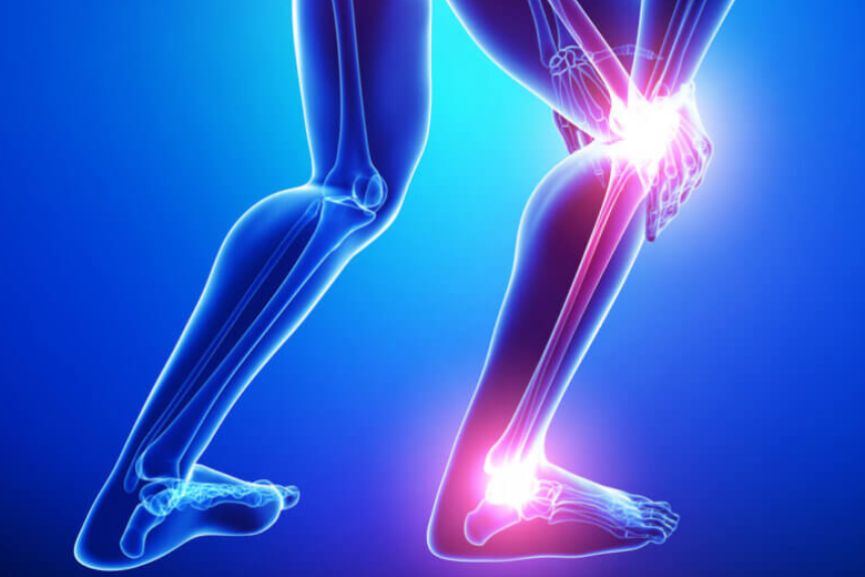 Theme Leg