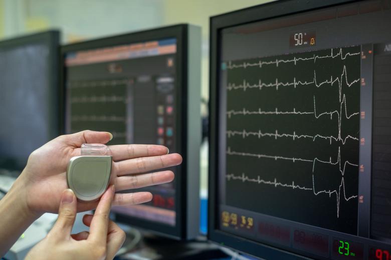 Pace maker and heart monitors