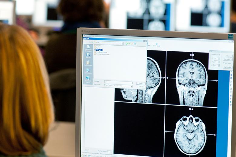 Woman looking at brain scans on computer screen