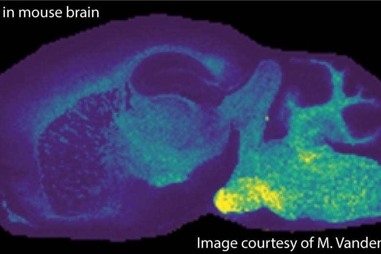 MSI Lipid in mouse brain