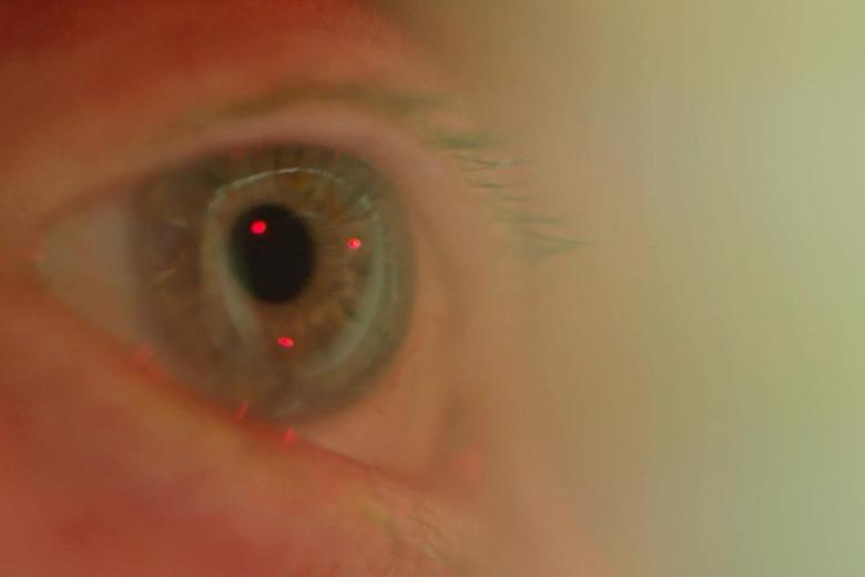Eye