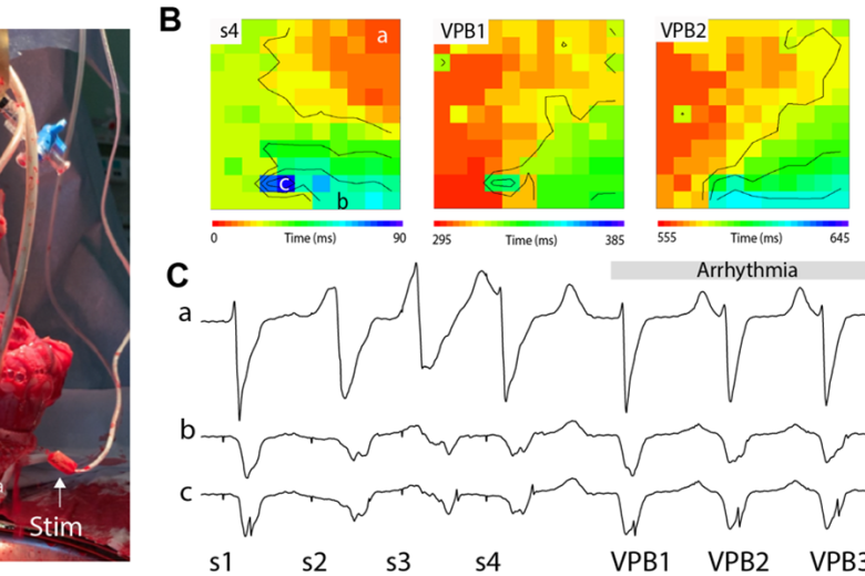 Figure 1 A & B